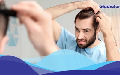 5 Early Signs of Balding